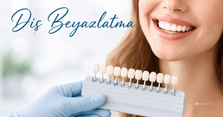 Diş Beyazlatma Nedir? Nasıl Uygulanır?
